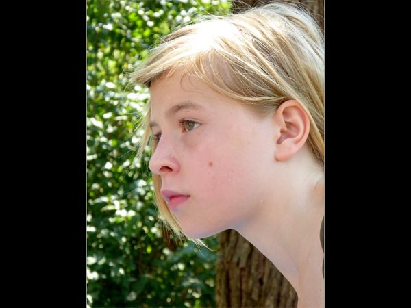 ಕೆನ್ನೆಯ ಮೇಲಿನ ಮಚ್ಚೆ ಕೆನ್ನೆಯ ಮೇಲಿನ ಮಚ್ಚೆ