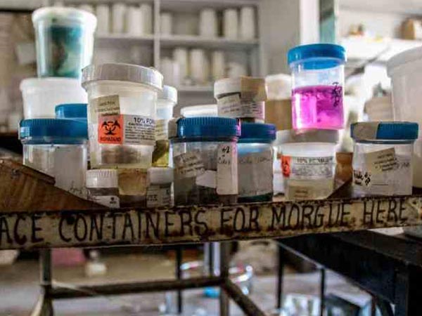 ರಕ್ತದ ಸ್ಯಾಂಪಲ್‌ಗಳು! 