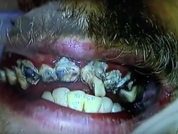 ಆತನಿಗೆ ತುಂಬಾ ಬಲಶಾಲಿ ಹಲ್ಲುಗಳಿವೆ!