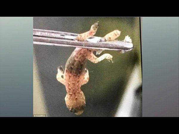 ಈ ನೋವಿಗೆ ಕಾರಣ ಏನು ಎಂಬುದು ಜೀವನದ ದೊಡ್ಡ ಶಾಕ್!