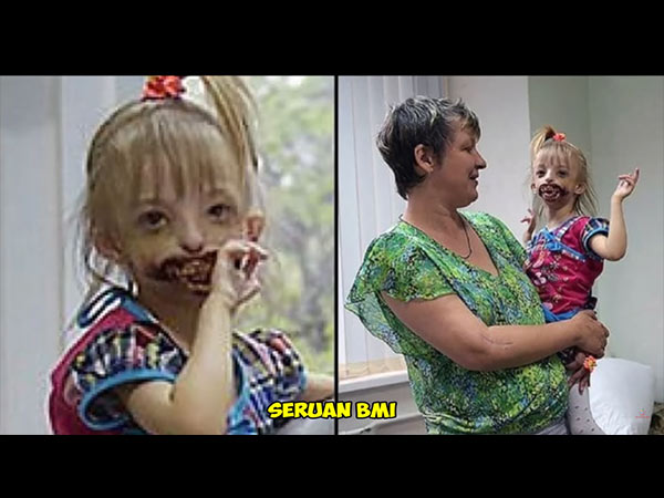 ಮಗುವಿಗಾಗಿ ಹೆತ್ತವರು ಹೋರಾಡಿದರು