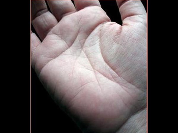 ಮರಕ್ಕೆ ಉಜ್ಜುವುದರಿಂದ ನೆರವಾಗುತ್ತದೆಯೇ?