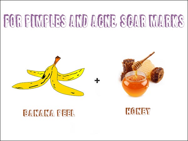 ಮೊಡವೆ, ಬೊಕ್ಕೆ ಮತ್ತು ಕಲೆಗಳಿಗೆ