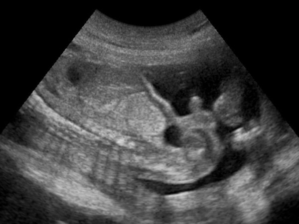 ಇದು ಸಂಭವಿಸಿದ್ದು ಚೀನಾದಲ್ಲಿ: