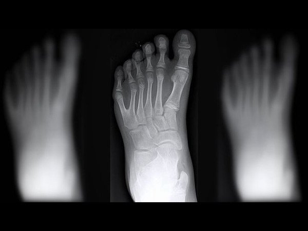 ಮತ್ತಷ್ಟು ಹೇಳುವುದಾದರೆ