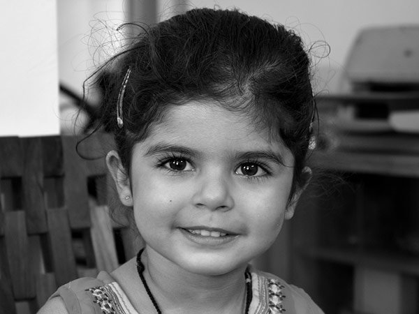 ಇಳಿಜಾರಾದ ಹಣೆ