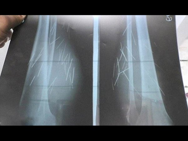 ಈಕೆಯ ವಿವರಣೆಯ ಪ್ರಕಾರ