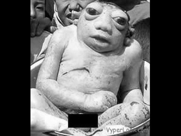 ಕಪ್ಪೆಮಗು