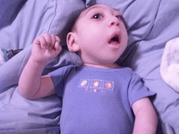 ಮೆದುಳೇ ಇಲ್ಲದ ಮಗು