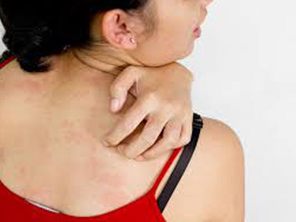 ಸೋಂಕು ಇರುವವರು