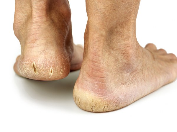 ಮೊಸರಿನ ರೆಸಿಪಿ 