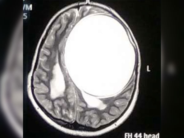 ಇದು ಭಾರತದ್ದೇ ಕಥೆ