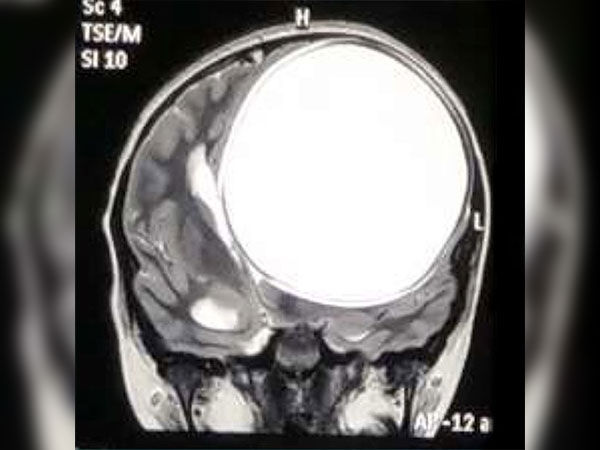 ನರರೋಗ ತಜ್ಞರನ್ನು ಭೇಟಿಯಾದರು