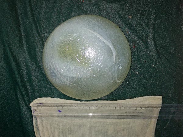 ಪರೀಕ್ಷೆ ವೇಳೆ ತಿಳಿದ ಸತ್ಯ...