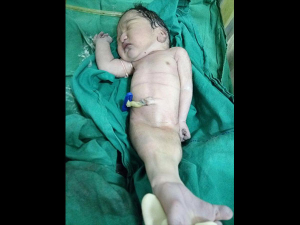 ವೈದ್ಯರು ಹೇಳುವ ಪ್ರಕಾರ...