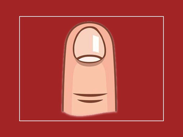 ಬಾದಾಮಿ ಗಾತ್ರದ ಉಗುರು