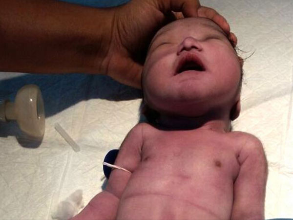 ಈ ಪರಿಸ್ಥಿತಿ ಬರಲು ಕಾರಣವೇನು?