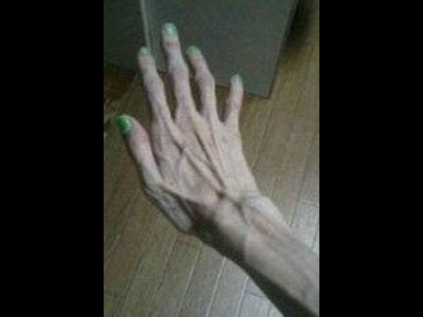 ತಿಂದುದನ್ನು ವಾಂತಿ ಮಾಡಿಸುತ್ತಿದ್ದ ಅಜ್ಜ