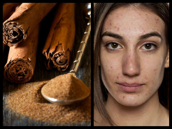 ದಾಲ್ಚಿನ್ನಿ ಮತ್ತು ಜೇನು ತುಪ್ಪ