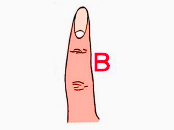 ಬಲ ಶಂಖಾಕೃತಿಯ ಅಚ್ಚು (The Radial Loop) ಬಲ ಶಂಖಾಕೃತಿಯ ಅಚ್ಚು (The Radial Loop)