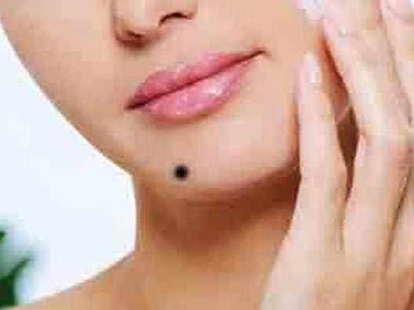 ಶುಕ್ರ ಪರ್ವದ ಮೇಲೆ ಮಚ್ಚೆ