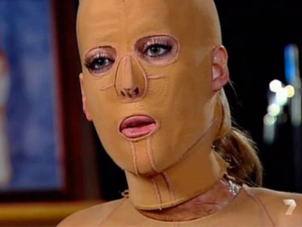 ಮಾಸ್ಕ್ ಆಕೆಗೆ ಕಿರಿಕಿರಿ ಉಂಟು ಮಾಡಿತು!