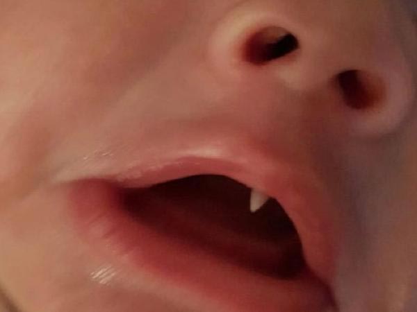 ಐರ್ಲೆಂಡ್ ನಲ್ಲಿ ನಡೆದ ಘಟನೆ