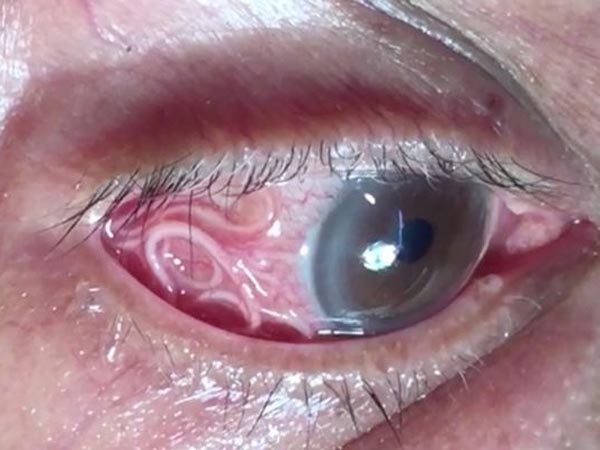 ಈ ಹುಳವನ್ನು ಹೀಗೆ ಕರೆಯಲಾಯಿತು...