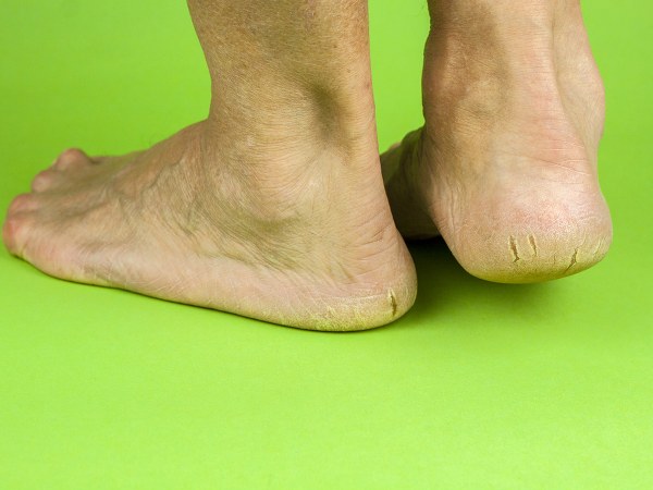 ಹಚ್ಚಿಕೊಳ್ಳುವುದು ಹೇಗೆ?