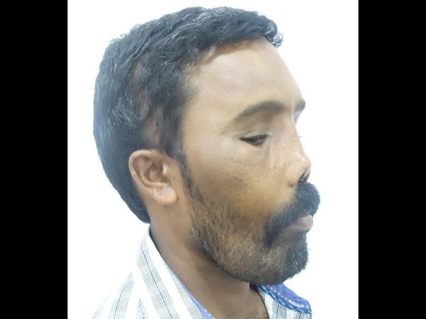 20 ವರ್ಷಗಳ ಬಳಿಕ ಚಿಕಿತ್ಸೆ ನೀಡಲಾಯಿತು