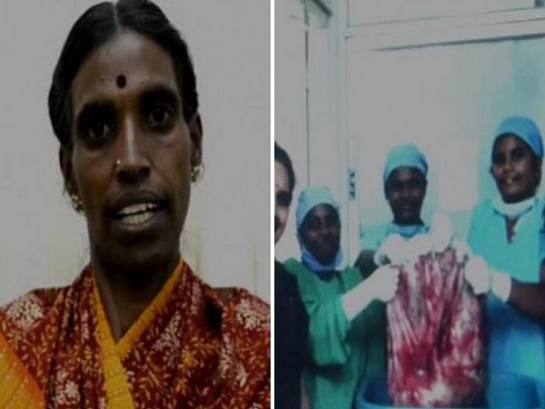 ಇದು ಅತೀ ಭಾರದ ಗರ್ಭಕೋಶದ ಕ್ಯಾನ್ಸರ್ ಗಡ್ಡೆ