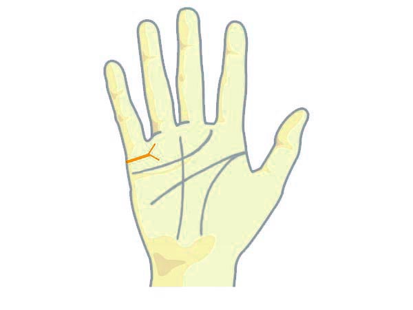 ಮದುವೆ ರೇಖೆ ತುಂಬಾ ಸಣ್ಣದಾಗಿ ಮೇಲೆ ಹಾಗೂ ಕೆಳಗಿದ್ದರೆ 