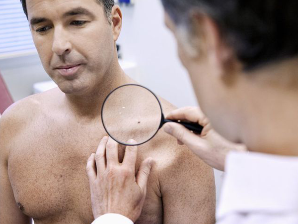 ಮಚ್ಚೆಯಲ್ಲಿ ಕೂದಲು ಬೆಳೆಯಲು ಕಾರಣವೇನು?