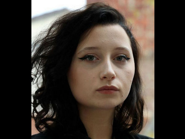 Woman’s Head Expanded After She Used Hair Dye