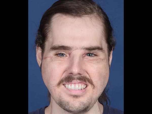 ಆತ ಮತ್ತೆ ನಗುತ್ತಿದ್ದಾನೆ