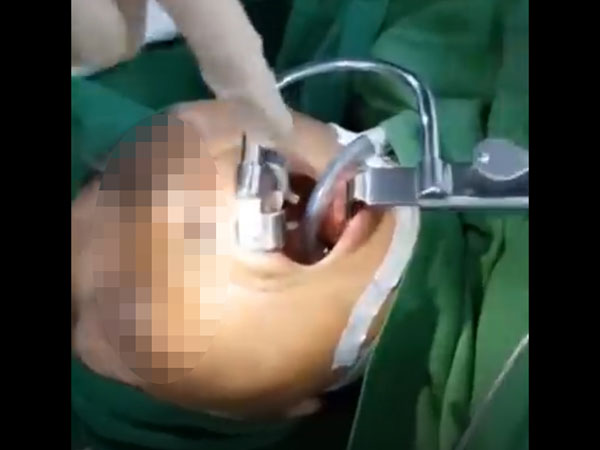 ಈ ವಿಚಿತ್ರ ಘಟನೆಯನ್ನು ಕ್ಯಾಮರಾದಲ್ಲಿ ಸೆರೆ ಹಿಡಿಯಲಾಗಿದೆ