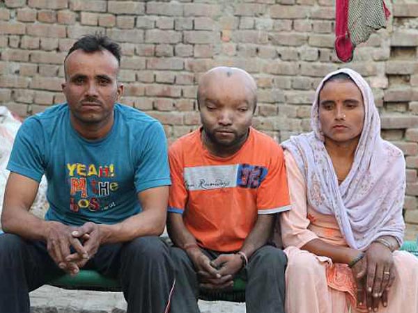 ಅಂಶು ಕುಮಾರ್ ಗೆ ಸಾಮಾನ್ಯ ಜೀವನ ಸಾಗಿಸಬೇಕೆಂಬ ಆಸೆಯಿದೆ