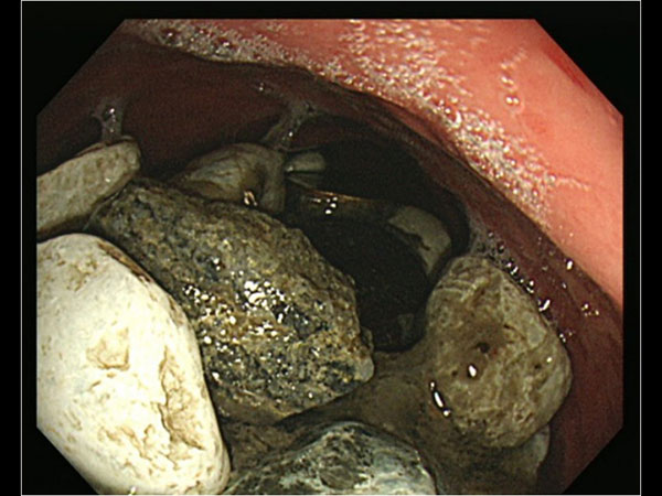 ಪರಿಶೀಲನೆ ವೇಳೆ ಕಂಡುಬಂದಿರುವುದು