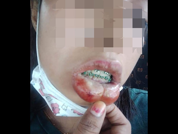 ವೈದ್ಯರು ಈ ಬಗ್ಗೆ ಮಾಹಿತಿ ಹಂಚಿಕೊಂಡರು ವೈದ್ಯರು ಈ ಬಗ್ಗೆ ಮಾಹಿತಿ ಹಂಚಿಕೊಂಡರು