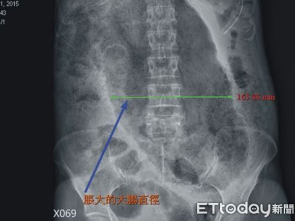 ಆತ ಸಾವಿನ ಸನಿಹಕ್ಕೆ ಬಂದಿದ್ದ