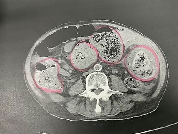 ಅನಾರೋಗ್ಯಕ್ಕೆ ಒಳಗಾದರು
