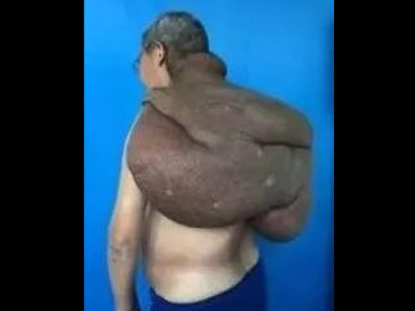 ಈ ಫೋಟೊಗಳು ಖಂಡಿತವಾಗಿಯೂ ನಿಮಗೆ ಆಘಾತ ನೀಡಬಹುದು