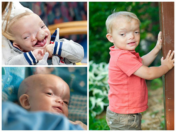 ಆತ ಬದುಕುವುದಿಲ್ಲ ಎಂದು ವೈದ್ಯರು ಹೇಳಿದ್ದರು