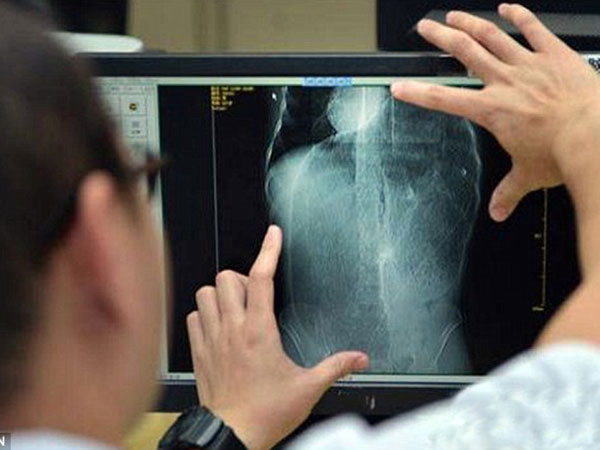 ಶಸ್ತ್ರಚಿಕಿತ್ಸೆ ನಡೆಸಲಾಯಿತು