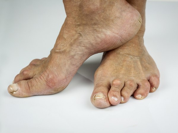 9 . ನಿಮ್ಮ ಪಾದಗಳನ್ನು ಪ್ರತಿದಿನ ಗಮನಿಸಿ 