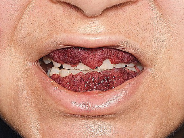 Strawberri Strawberri