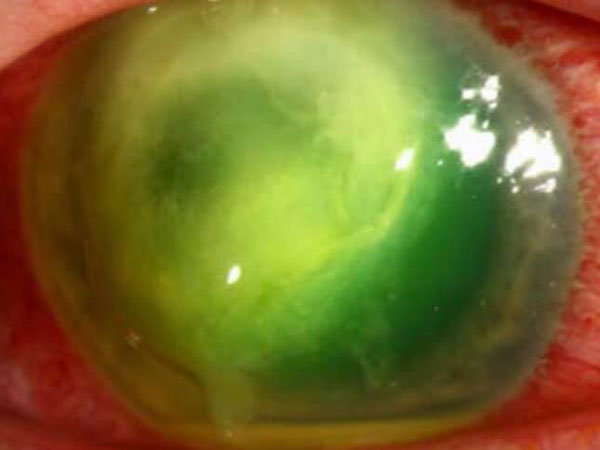 ವೈದ್ಯರು ಹೇಳುವ ಪ್ರಕಾರ