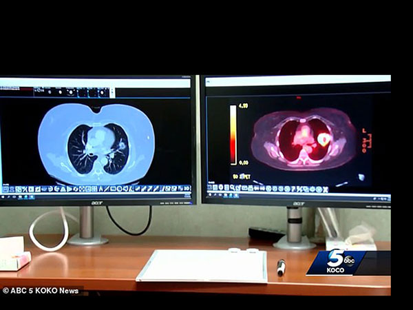 ಕೀಟಬಾಧೆಗೆ ತೆಗೆದುಕೊಳ್ಳುವ ಔಷಧಿ ತೆಗೆದುಕೊಳ್ಳಲು ನಿರ್ಧರಿಸಿದ ಕೀಟಬಾಧೆಗೆ ತೆಗೆದುಕೊಳ್ಳುವ ಔಷಧಿ ತೆಗೆದುಕೊಳ್ಳಲು ನಿರ್ಧರಿಸಿದ