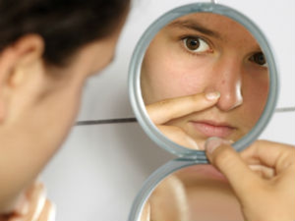 ಕಣ್ಣ ಕೆಳಗಿನ ಕಪ್ಪು ವರ್ತುಲಗಳು