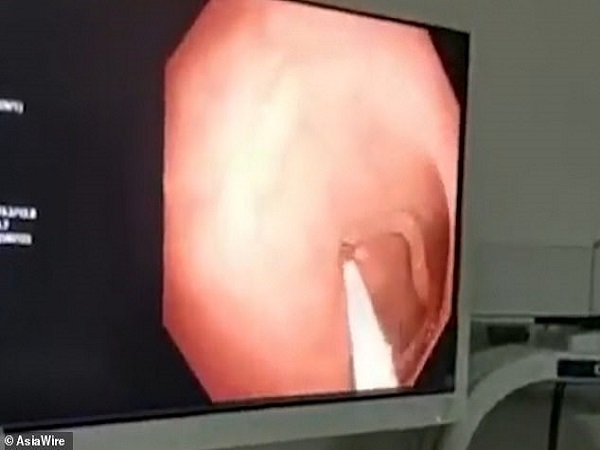 ಡಾ. ಲೀ ಜುಯಾನ್ ಹೇಳುವ ಪ್ರಕಾರ